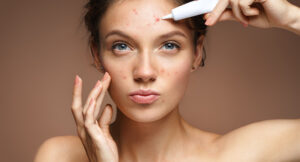CIDP Explores the Effect of Pollution on Common Dermatological Pathologies